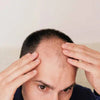 Comprendre la Perte de Cheveux et les Problèmes Capillaires